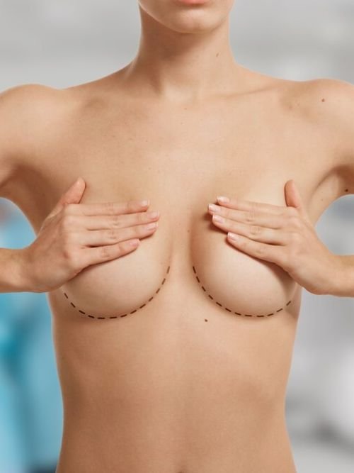 Cirurgia Mamaria