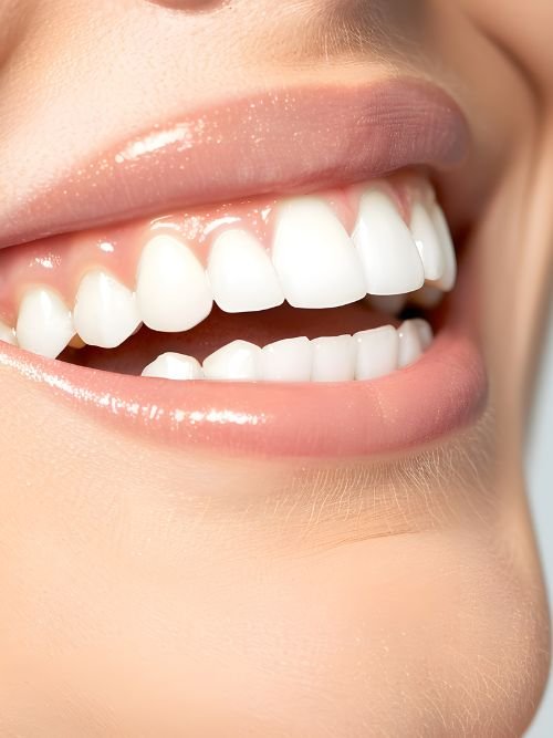 sorriso